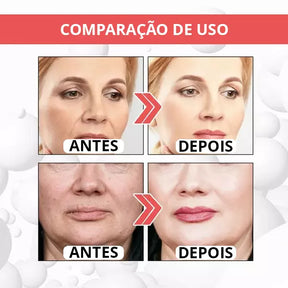 Botox UP - [TRATAMENTO DE MINUTOS] + 1 BRINDE EXCLUSIVO